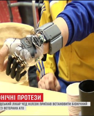 Лікар з Канади приїхав в Україну, щоб встановити протез воїну АТО